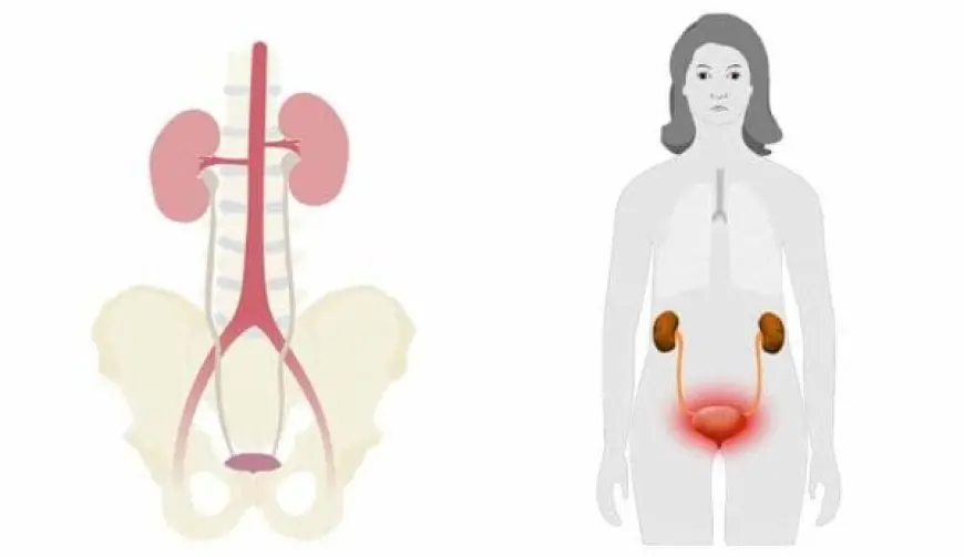 أفضل الأعشاب لعلاج التهاب المسالك البولية