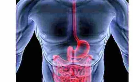 أعراض القولون العصبي وعلاجه