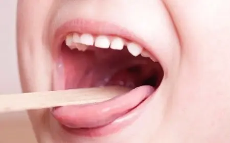 علاج التهاب اللوزتين في المنزل