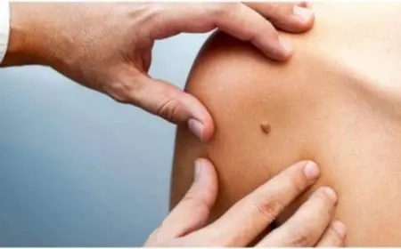 هل يمكن الشفاء من فيروس hpv