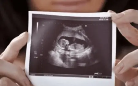 ما هي مراحل سقوط حلقة الختان للذكور؟