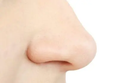 هل الأنف الكبير جميل