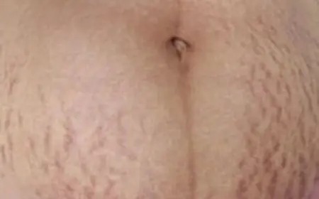 هل الخطوط الحمراء تزول