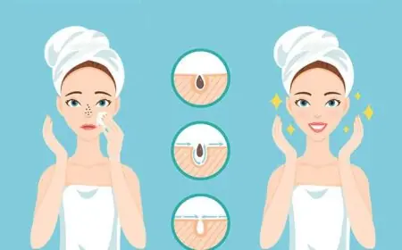 إزالة الرؤوس السوداء من الوجه في 10 دقائق فقط