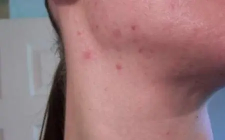 فوائد زيت الصبار للبشرة