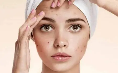 أسباب زيادة إفراز الدهون في الوجه