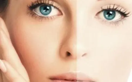 هل يعود لون البشرة بعد الاسمرار من الشمس