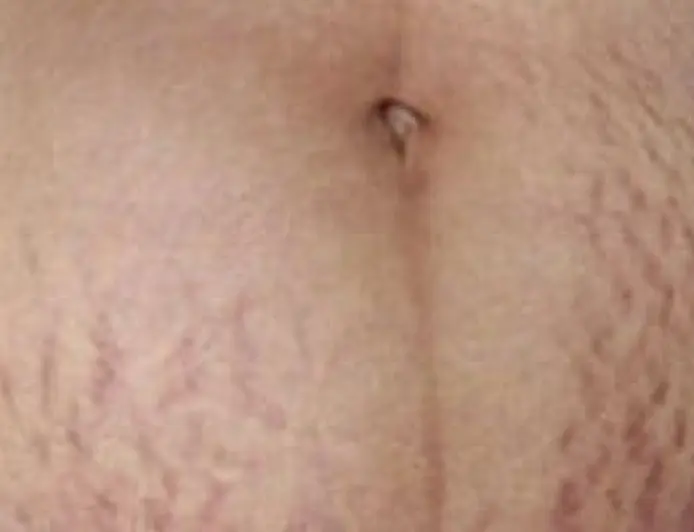 هل الخطوط الحمراء تزول