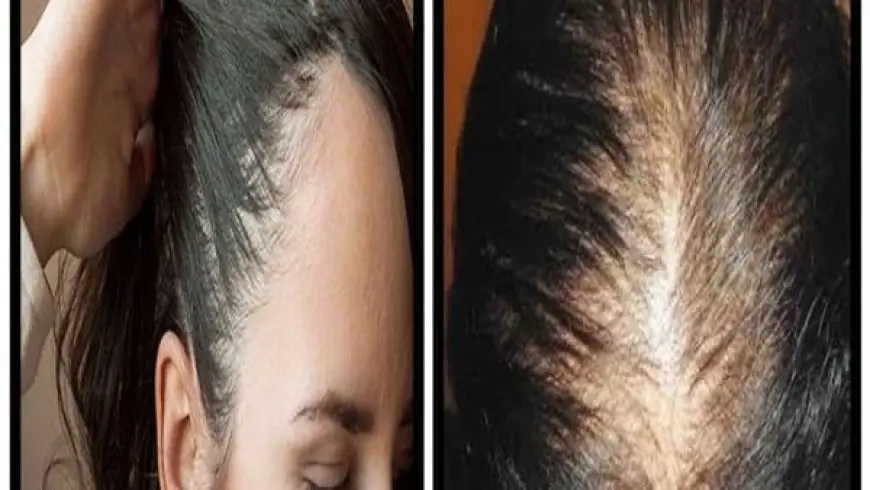 افضل الحبوب لسد الشهية وحرق الدهون من الصيدلية